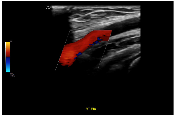 Quiz 2 ultrasound imaage